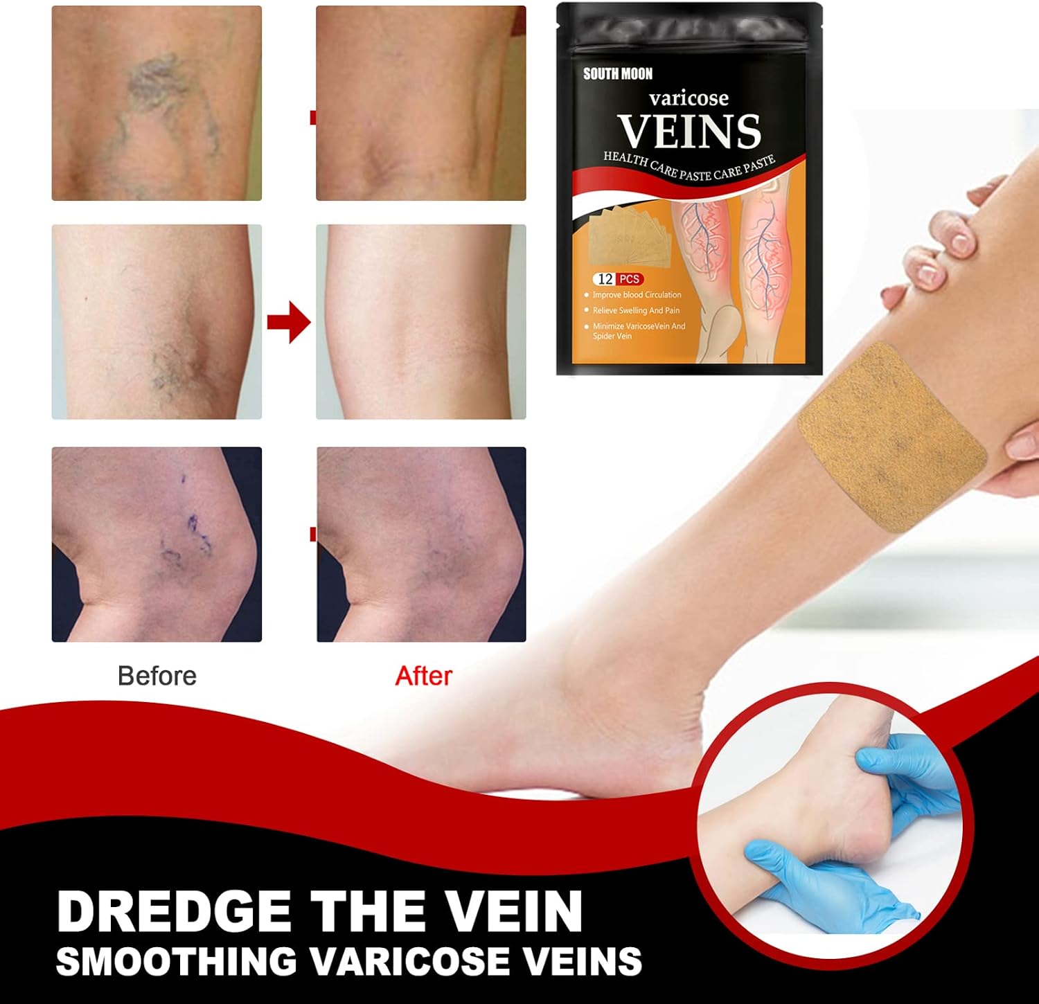 Patchs Herbales Anti-Varices Soulagement Douleur, Amélioration Circulation 12Pcs - لاصقات الأعشاب الطبيعية لعلاج الدوالي والدورة الدموية - 3