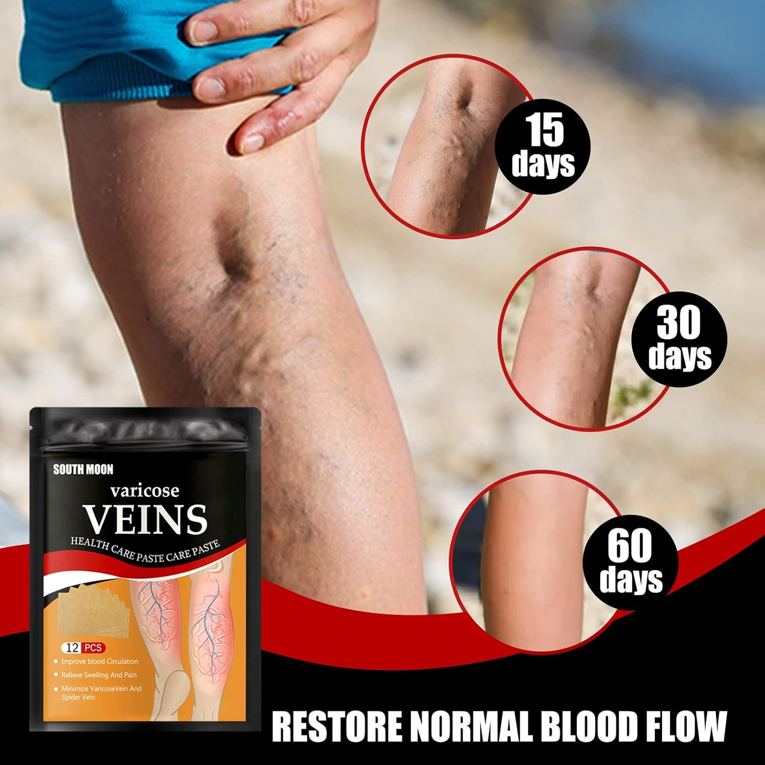 Patchs Herbales Anti-Varices Soulagement Douleur, Amélioration Circulation 12Pcs - لاصقات الأعشاب الطبيعية لعلاج الدوالي والدورة الدموية - 2