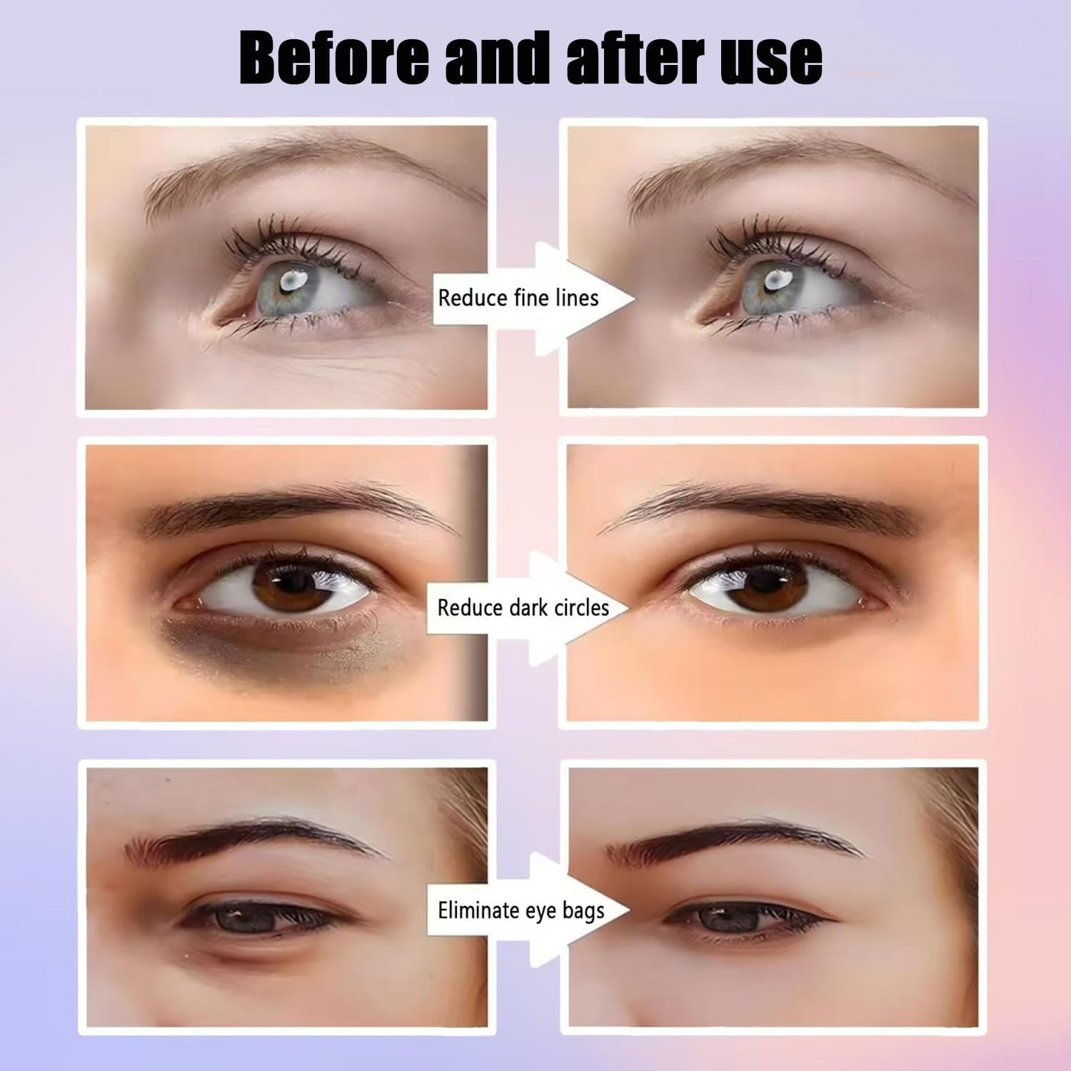 Masseur Yeux Rajeunissant Anti-Poches par Photothérapie Lumière Rouge - نظارة وقناع مساج وتجميل محيط العين بالضوء الأحمر والاهتزاز - 4